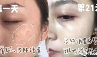 去黄提亮应该用什么产品 去黄美白产品排行榜